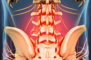 Αιτίες και συμπτώματα της οστεοχόνδρωσης
